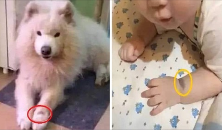 Woman Assures That Her Baby Is The Reincarnation Of Her Dog Due To Birthmark